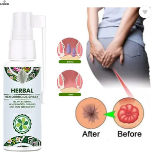 HEMORROIDES SPRAY HERBAL