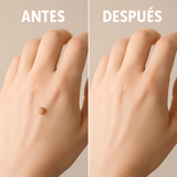 Crema eliminador de Verrugas