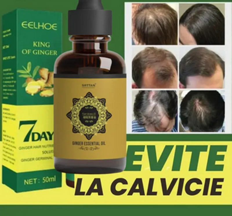 Tónico de crecimiento capilar de jengibre