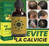 Tónico de crecimiento capilar de jengibre